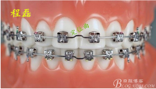 纯钛牙套价格,深度解析与科普